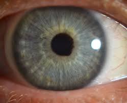 Lymphatische Konstitution Rosto Fotografia Olhos