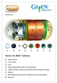 Image result for Wireless Capsule Endoscopy
