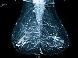 Bitte wenden sie sich in diesen fällen an die universitätsklinik leipzig (mvz radiologie) oder an das st. Radiologie Hamburg Facharzt Praxis Medizinicum