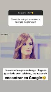 Gala caldirola presentó en video a los dos nuevos integrantes de su hogarby noticias 24h sub channel. Gala Caldirola Recuerda Dolorosa Cirugia Maxilofacial Que Se Hizo Tras Un Accidente Y Muestra Fotos T13