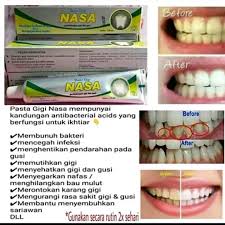 Pasta Gigi Nasa Paket 10pcs Odol Pemutih Gigi Original 100 Sikat Gigi Herbal Dengan Ekstrak Cengkeh Paket 10 Pasta Gigi Nasa Pasta Gigi Nasa Isi 10 Pasta Gigi Nasa Anak