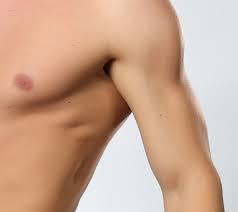 Fallbeispiele zur behandlung post operativer wunden ligamed. Haut Medical Beauty Concepts Entfernen Von Haut Tumoren