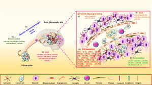 Metastatic breast cancer occurs when the cancer has spread to other parts of the body. Micrornas Orchestrate Pathophysiology Of Breast Cancer Brain Metastasis Advances In Therapy Molecular Cancer Full Text