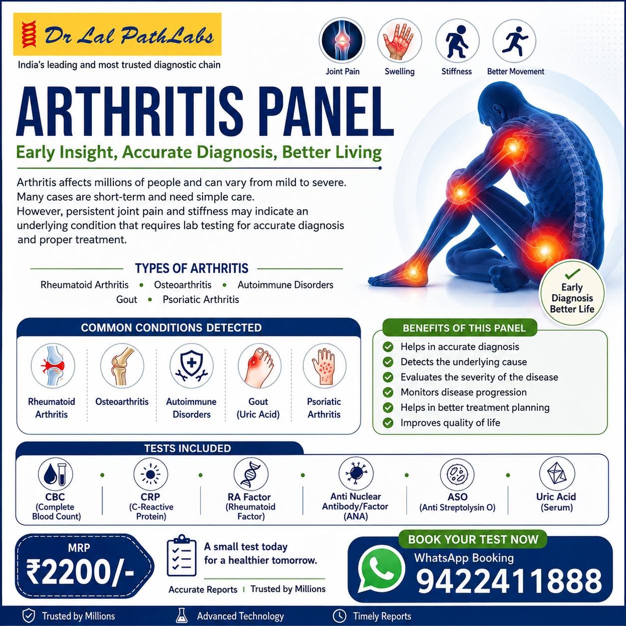 Comprehensive Arthritis Panel product image