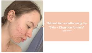 This isn't the product i use but the one i have isn't on here. Jshealth Vitamins Welcome To The Jsh Club Milled