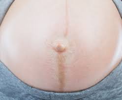 When u poke your belly button. Linea Nigra Pregnancy Line American Pregnancy Association
