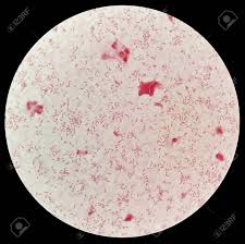 It has abundant transporter systems to adapt to ever changing ph, osmolarity, and concentration of urea in human urine. Hemocultured Smear Of Gram Negative Bacilli Bacteria Under 100x Stock Photo Picture And Royalty Free Image Image 92662950