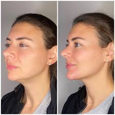 Nadia Ryan RN, BSN (@nadiaryan.rn) • Instagram photos and videos