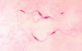 Chagas Disease In Dogs Vca Animal Hospital