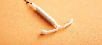 Spiral Taktirma Fiyati 2020