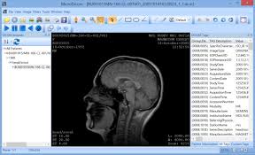 Zuum dicom viewer has had 1 update within the past 6 months. Microdicom Free Dicom Viewer For Windows View Image Windows Image