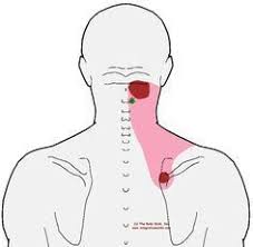 Pin On Fibro Fact And Fiction