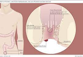 Storsignale Aus Dem Anus Nzz