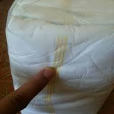 Pampers Dewasa Paling Murah Rm10 Xl Shopee Malaysia