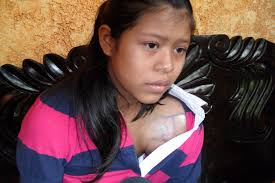 SAN CRISTÓBAL VERAPAZ: 2011