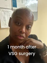 Best decision I've made #vsgjourney #4weekspostop