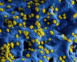 De verdere versoepelingen van de coronaregels, zoals het openen van sportscholen en dierentuinen laten langer op zich wachten. Svrz Coronavirus Svrz