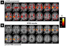 After the official declaration below jawahar navodaya vidyalaya test results for class 11 will be activated immediately. Clustering Of Fmri Data The Elusive Optimal Number Of Clusters Peerj