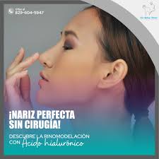 La nariz que siempre soñaste, sin cirugía! ✨ La rinomodelación con ácido  hialurónico te permite realzar tu belleza natural. Resultados inmediatos y  duraderos. ¡Agenda tu cita con la Dra. Stephany Ramírez! 829-604-5947 #