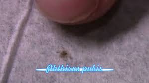 Image result for pubic lice symptoms