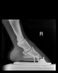 He was taken to the western country in later life. Low Foot Case Study Dixie S Farrier Service