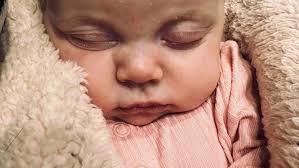 Fundraiser by Michelle Andreas : Help Bailey's Fight Against Rare Disorder  for Survival