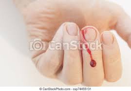 Over 328,402 blood pictures to choose from, with no signup needed. Closeup Of Finger Human Hand Is Cut Hurt Bleeding With Bright Red Blood Bleeding Blood From The Cut Finger Wound Injured Canstock