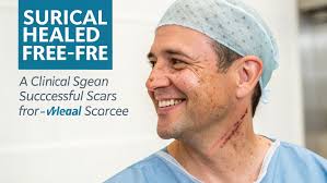 Sunat yang Bagus dan Proses Penyembuhannya