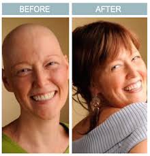 Cancer Center At WJMC To Offer Wig Clinics