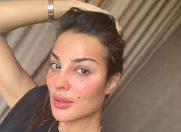 السلطات حاولت التقليل من خطورته، بيد أن حذف مقال لبلدية المدينة التي وقع بالقرب منها الانفجار رفع مستوى الشكوك. Ù…ÙˆÙ‚Ø¹ Ø®Ø¨Ø±Ù†ÙŠ Ù†Ø§Ø¯ÙŠÙ† Ù†Ø¬ÙŠÙ… ØªÙƒØ´Ù Ù…Ø§ ÙØ¹Ù„Ù‡ Ø§Ù†ÙØ¬Ø§Ø± Ø¨ÙŠØ±ÙˆØª ÙÙŠ Ø¹ÙŠÙ†Ù‡Ø§