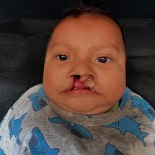 Fatima has been part of our program since her birth! Throughout the years,  she has participated in our milk program, undergone multiple surgeries,  received dental treatment, and is currently enrolled in our