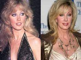 Beth smith dehart, profile picture. Morgan Fairchild Plastic Surgery Before And After Celeb Surgery
