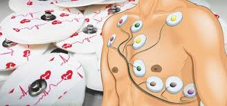 12 lead ecg placement