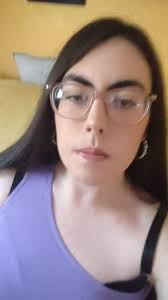 @meg🙈 we're gonna ignore the burn that till didn't heal