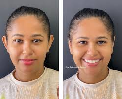 Instituto Priscilla Barros (@dra.priscillabarross) · Instagram 照片和视频