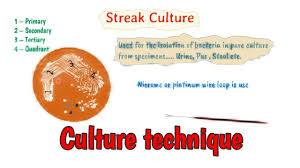What is the culture media in microbiology? Culture Methods Technique Microbiology Culture Techniques Youtube