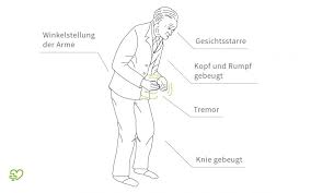 Parkinson's disease symptoms include muscle rigidity, tremors, and changes in speech and gait. Morbus Parkinson Symptome Verlauf Lebenserwartung Medikamente Onmeda De