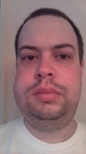 Fundraiser by Jonathan Fix : Airway & Facial Reconstruction Bills