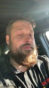 Knocked my tooth out with a tire bar. Got it fixed. Eating chicken wings.  Fell out. Lol 😂