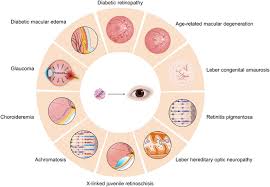 Image result for Gold 1997 AAV