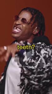 Who is this singer who’s missing his two front teeth? Everyone, let me  introduce you to the French Cameroonian singer Yamê 🔥 #yame #becan #music  #frenchmusic #colors