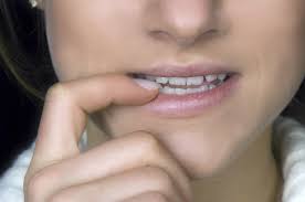 Ultimamente Noto Que Aprieto Los Dientes Que Puedo Hacer