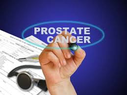 Image result for Prostate Cancer Staging