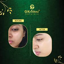 Rose Day Cream With SPF 30