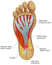 Image result for Foot Pain