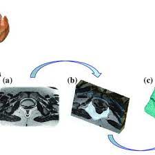 Check spelling or type a new query. Pdf Ischemic Region Segmentation In Rat Heart Photos Using Drlse Algorithm