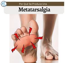 Image result for Metatarsalgia