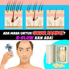 Bila mandi aje rasa takut tengok rambut gugor kat lantai. Rambut Gugur Boleh Menjadi Satu Mimpi Care Island Hair Facebook