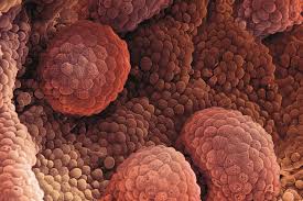 Surviving prostate cancer cells have become evident again on evaluation. Prostate Cancer Risk Factors And Diagnosis The Pharmaceutical Journal