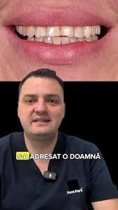 O nouă pacientă tânără, cu provocări estetice și funcționale clare.,  Lipsuri dentare în zonele laterale, dezechilibru ocluzal, disconfort  constant., Un astfel de caz nu se rezolvă în grabă., A fost ...